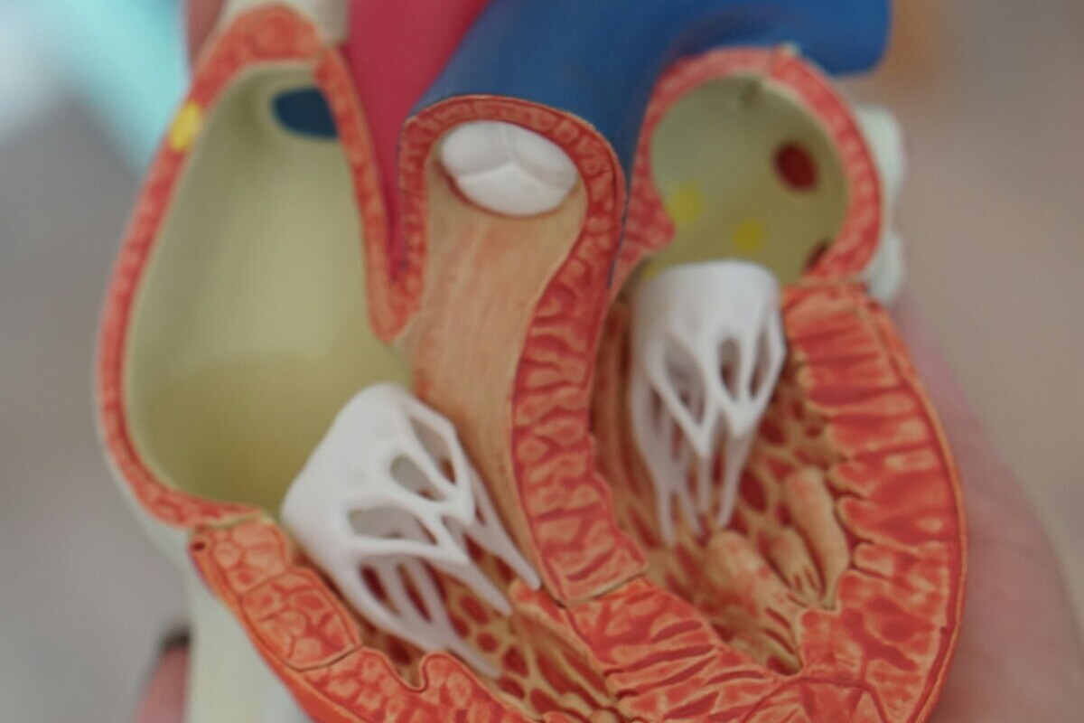 Рак серця: причини рідкості захворювання
